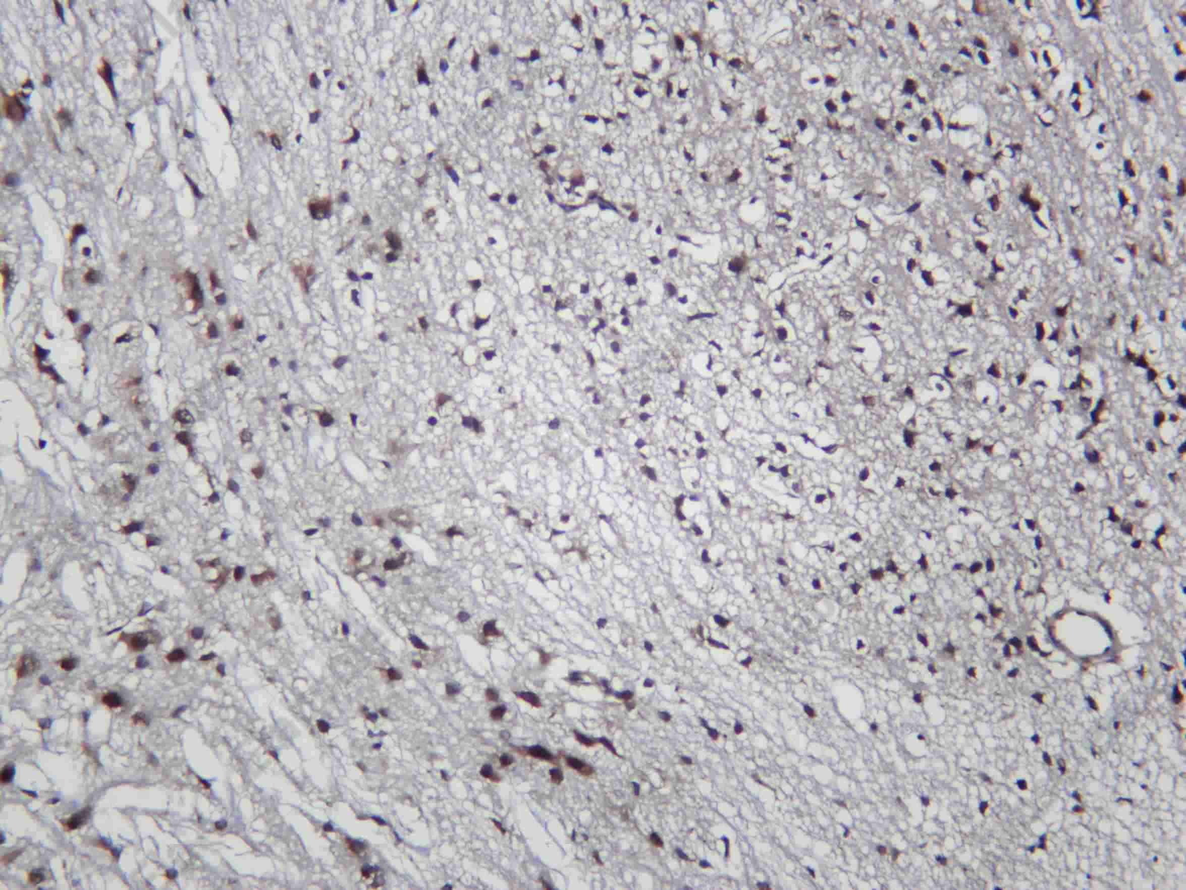 Recombinant D3DR Monoclonal Antibody - 2