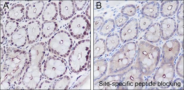 Recombinant Histone H3 (Di Methyl Lys14) Monoclonal Antibody - small - 4