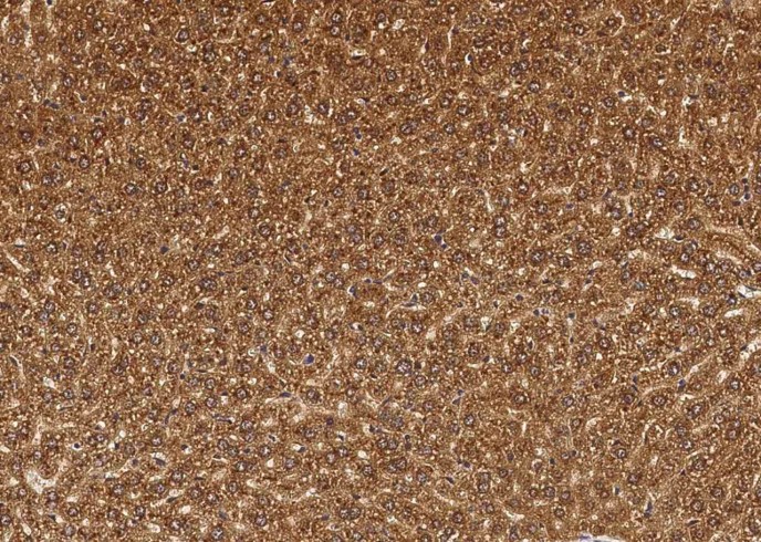 Recombinant Cathepsin B/CTSB Monoclonal Antibody-searchlist-1