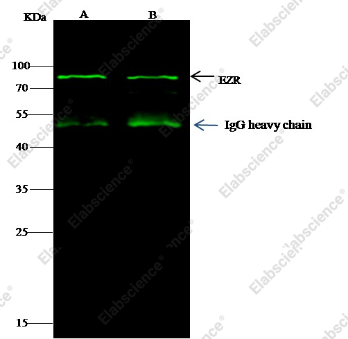 Ezrin/villin 2/EZR Monoclonal Antibody - 2