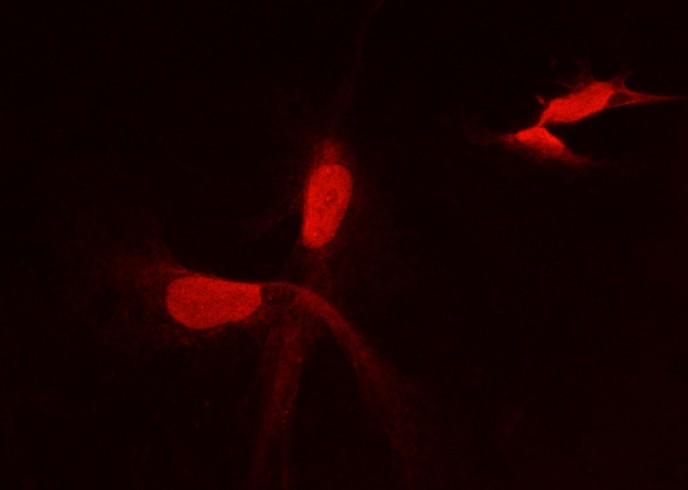 PFDN2 Monoclonal Antibody-searchlist-1
