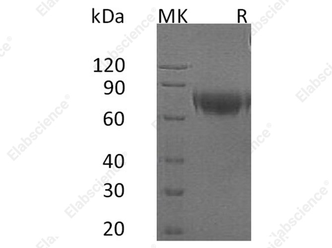 Recombinant Human IFNAR2 Protein (Fc Tag) - 1