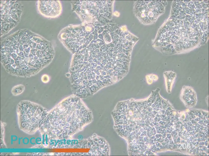 NCI-H1944 Cell Complete Medium - small - 5