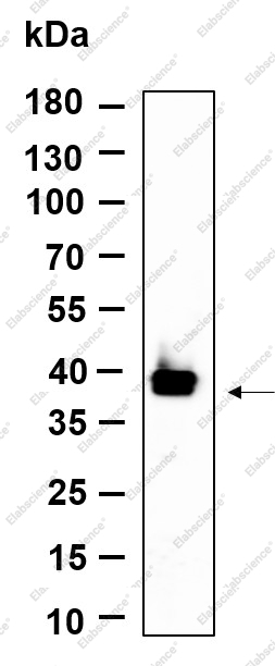 Recombinant dbx2 Monoclonal Antibody - 1