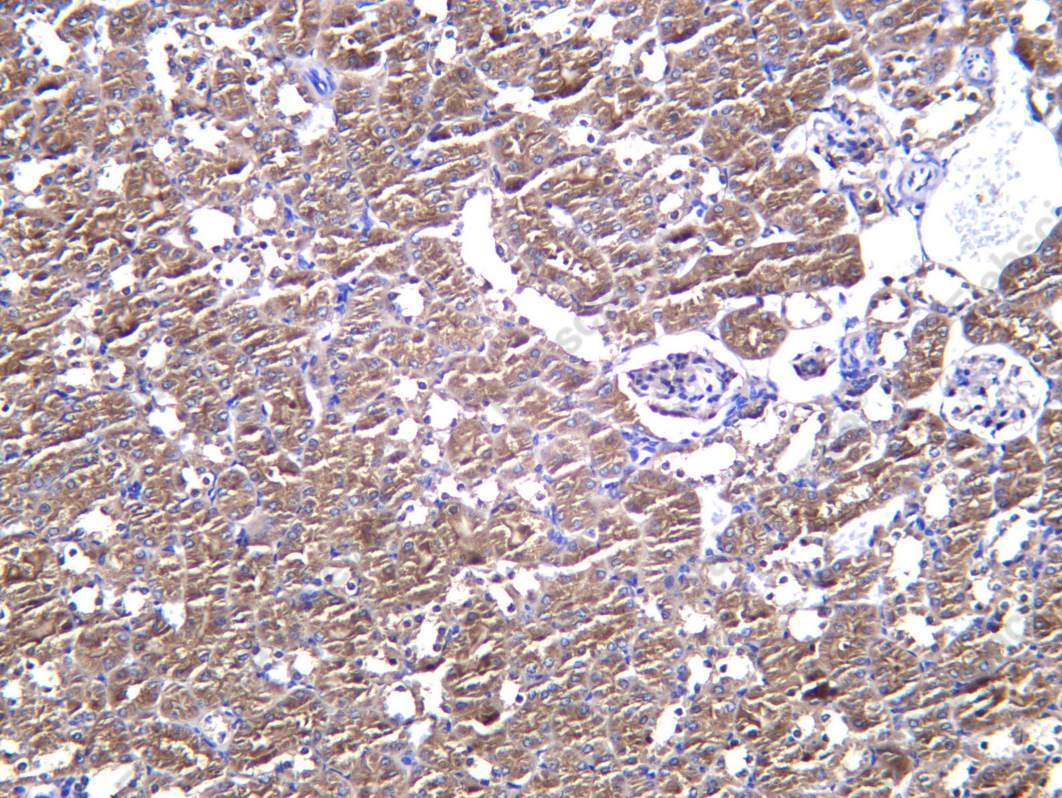 Recombinant AP2A1 Monoclonal Antibody - 2