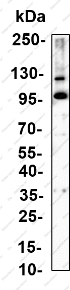 Recombinant β Catenin (Phospho Ser552) Monoclonal Antibody - 2