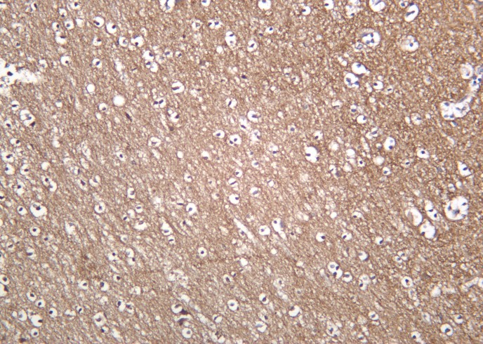 Recombinant Trk A Monoclonal Antibody-searchlist-1