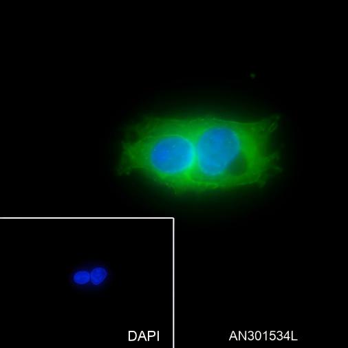 Recombinant Glypican 3 Monoclonal Antibody - 2