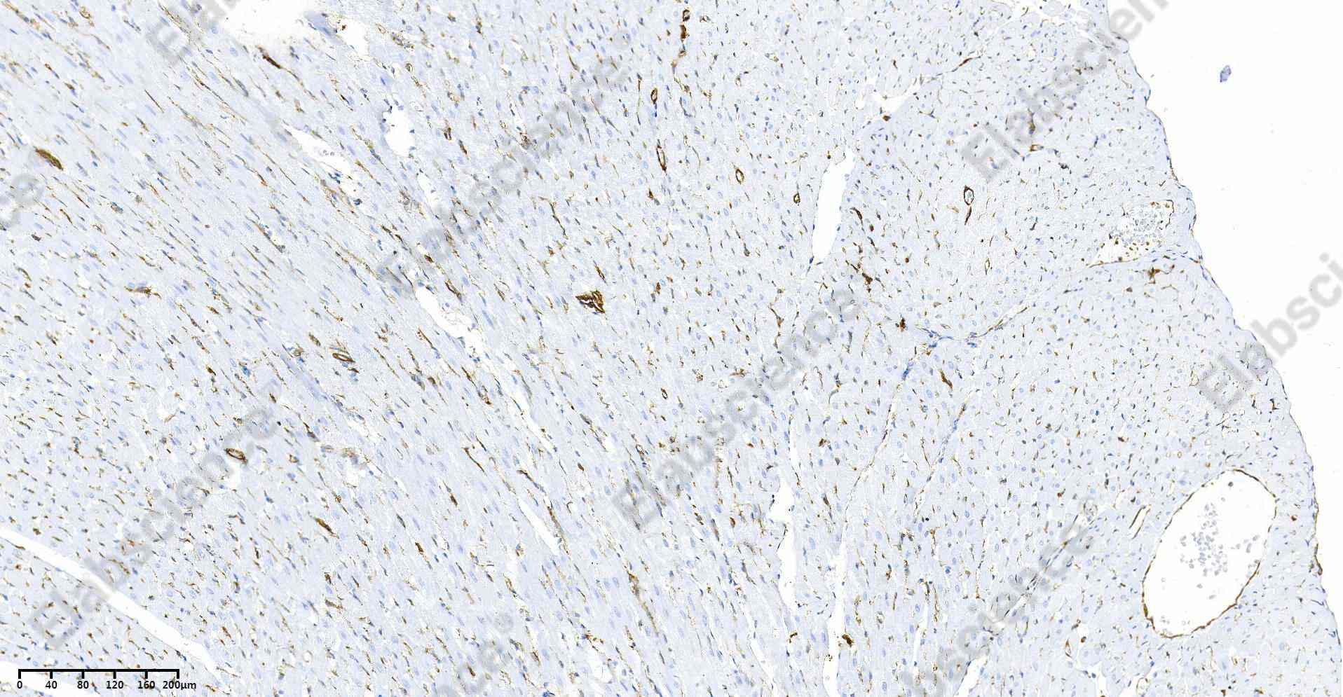 Recombinant α smooth muscle actin Monoclonal Antibody - 6