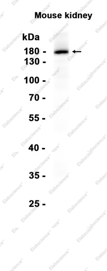 Recombinant Angiotensin Converting Enzyme 1 Monoclonal Antibody - 1