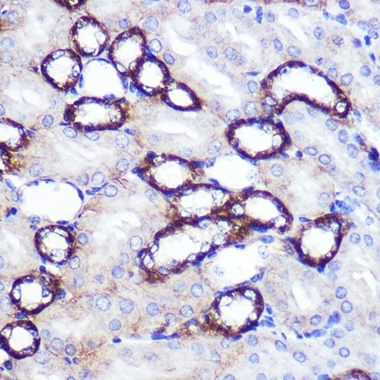 SIRT2 Polyclonal Antibody - small - 4