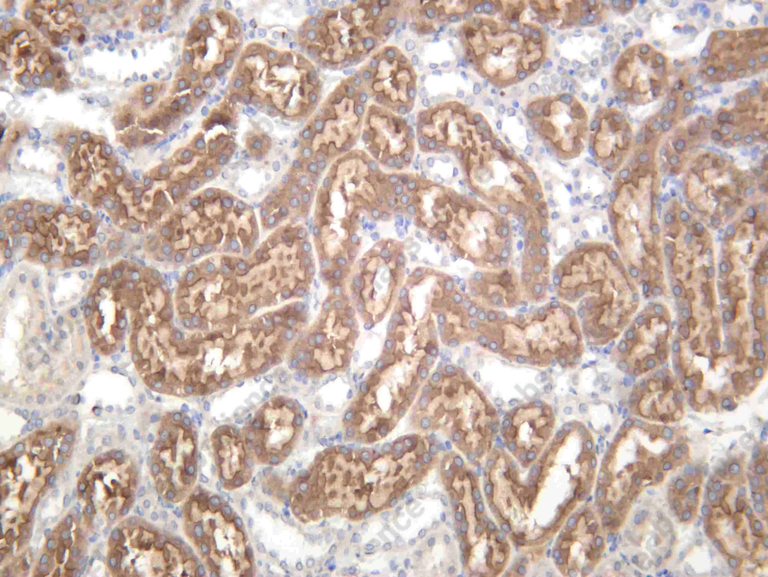 Recombinant CD46 Monoclonal Antibody - 3