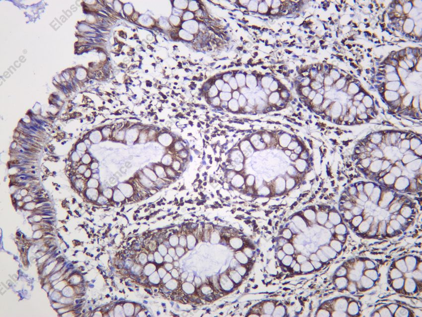 Recombinant PTGER2 Monoclonal Antibody - 2