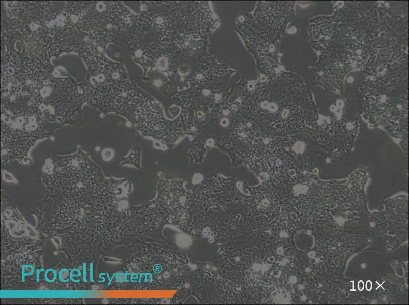 SW1417 Cell Complete Medium - 3