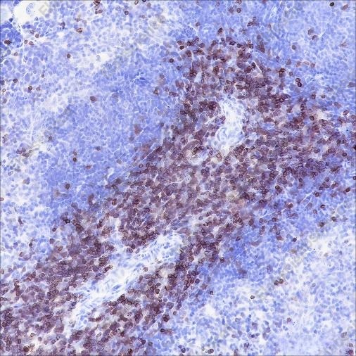 Recombinant CD3 epsilon Monoclonal Antibody - 5