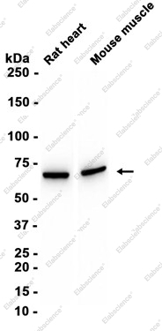 Recombinant Pyruvate Dehydrogenase E2 Monoclonal Antibody - 3
