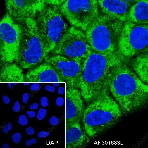 Recombinant RMP/C19orf2 Monoclonal Antibody - 3