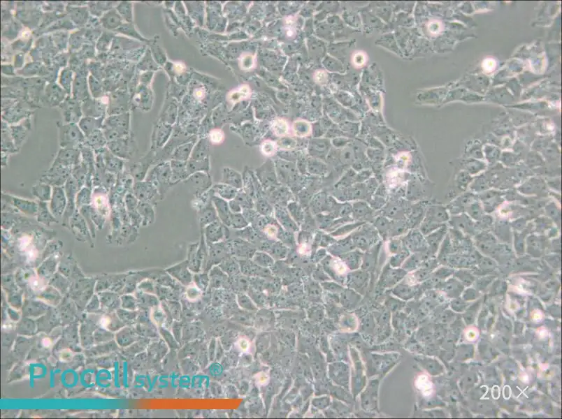 SK-N-AS Cell Complete Medium - small - 6