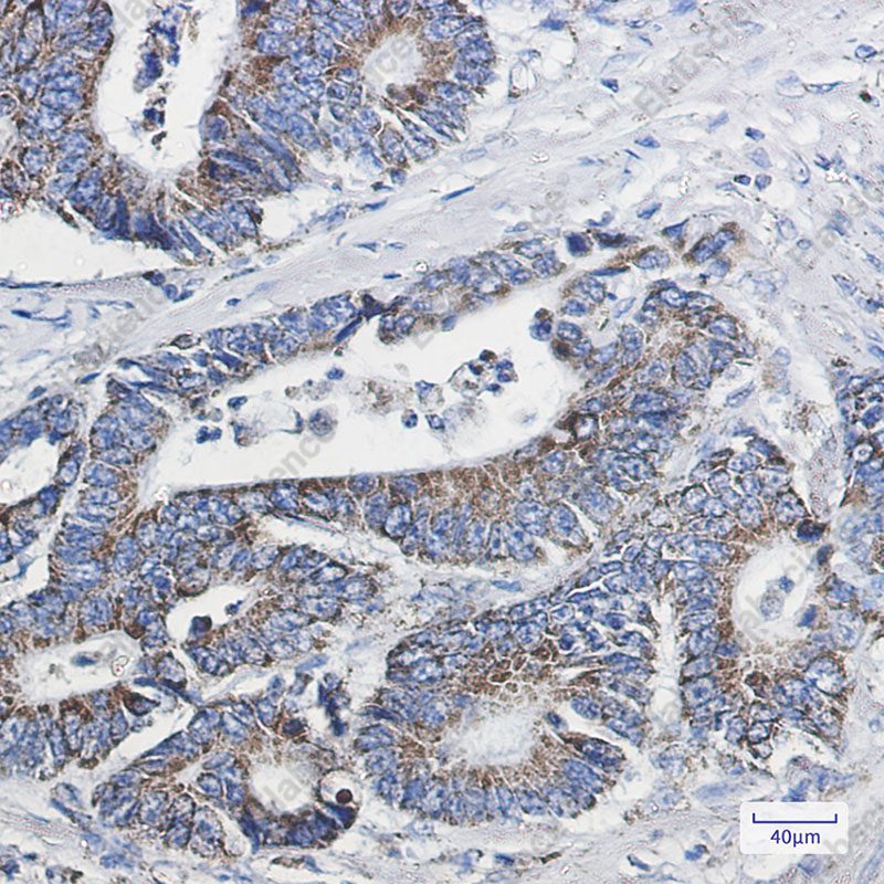 Recombinant NDUFB10 Monoclonal Antibody - 3