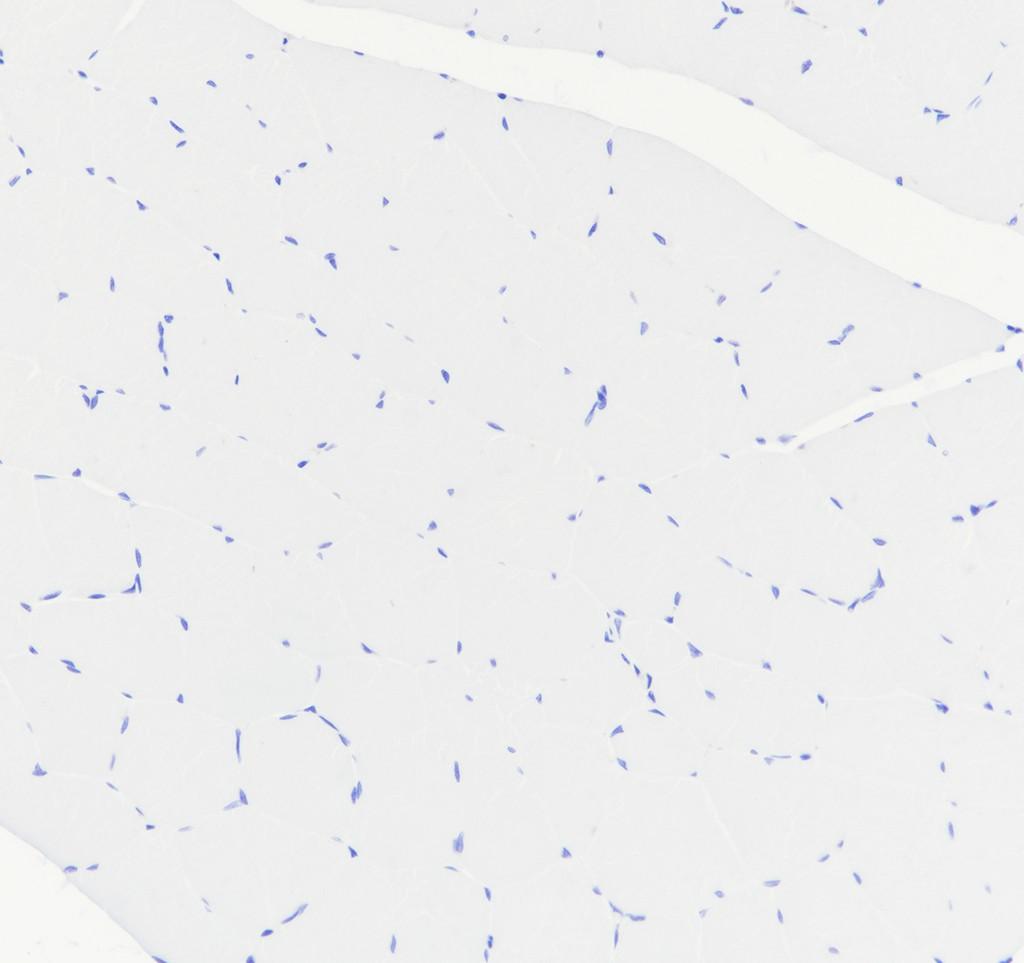 Recombinant CTCFL Monoclonal Antibody - 3