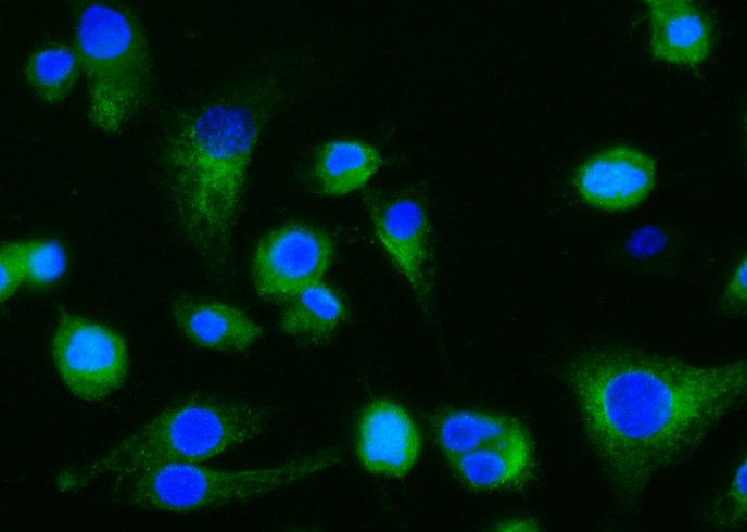 Recombinant Dectin-1/CLEC7A Monoclonal Antibody-searchlist-1