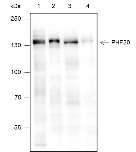 Recombinant PHF20 Monoclonal Antibody-searchlist-1