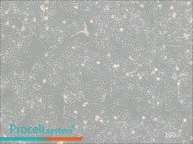 HCT 116 Cell Complete Medium - 2