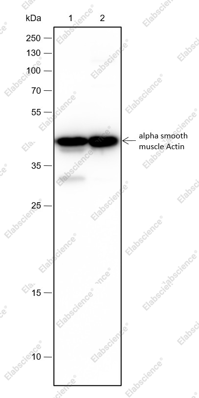 Recombinant alpha smooth muscle Actin Monoclonal Antibody - 2