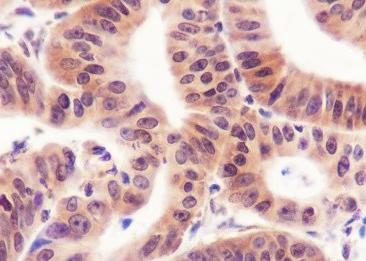 Recombinant Cyclin D2 Monoclonal Antibody-searchlist-2