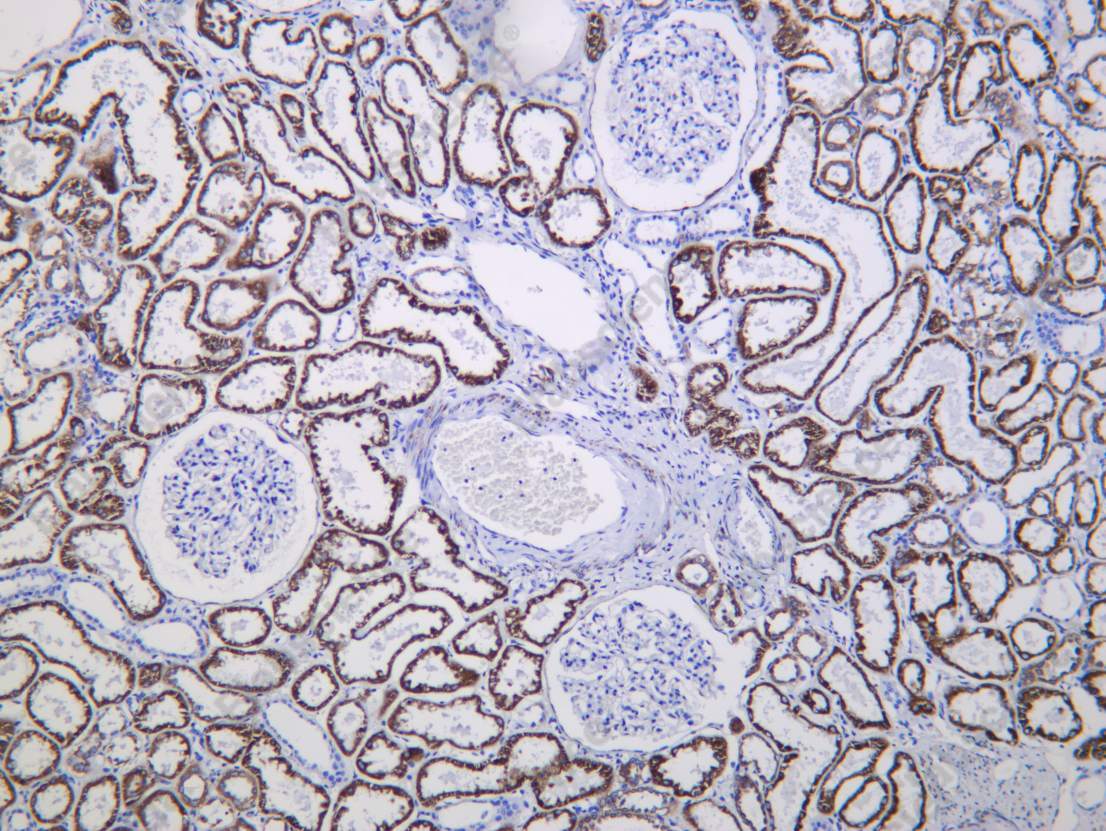 Recombinant MAOB Monoclonal Antibody - 1