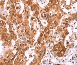 NCEH1 Polyclonal Antibody - 3