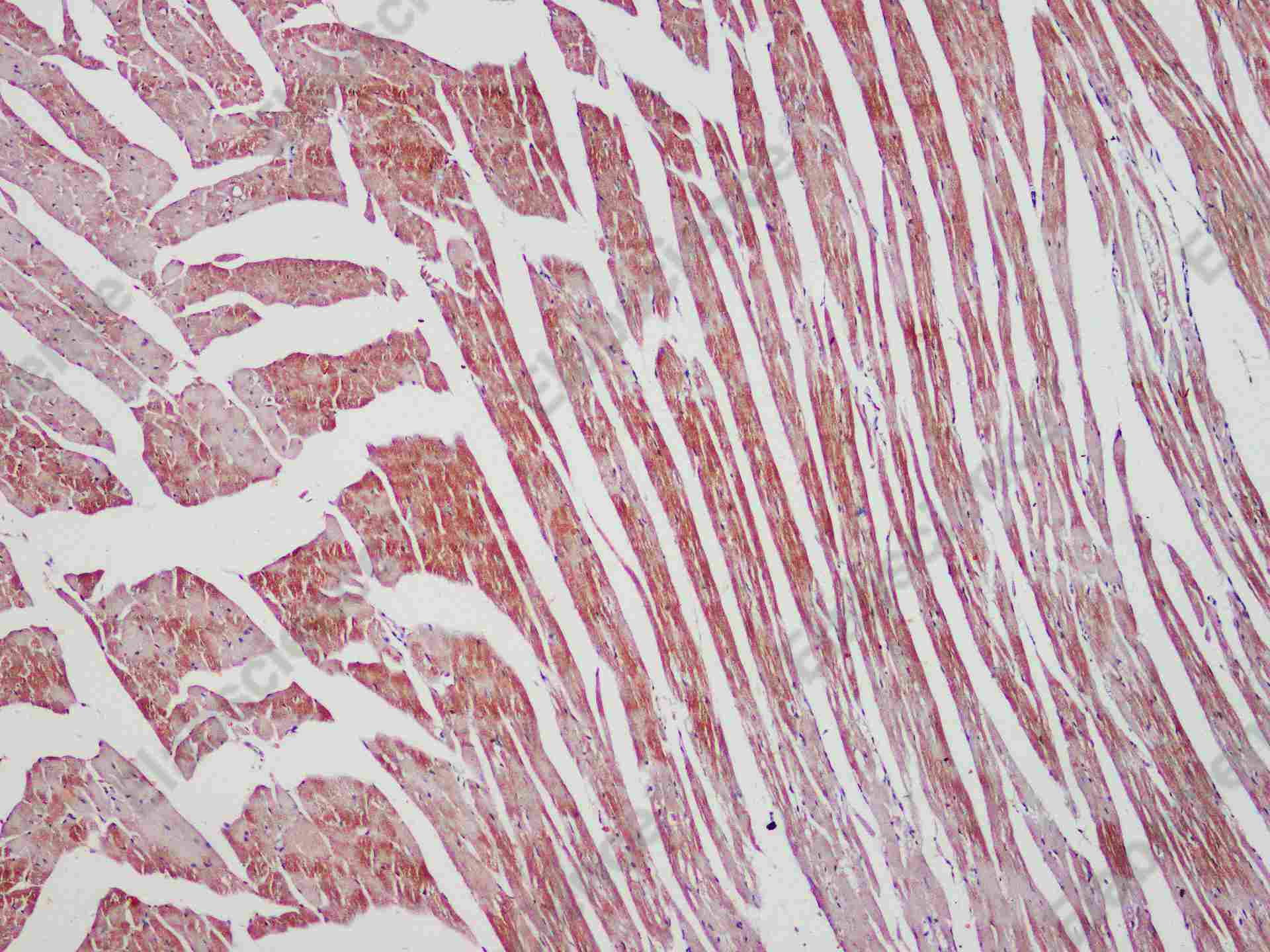 Recombinant Actinin-α2 Monoclonal Antibody - 1