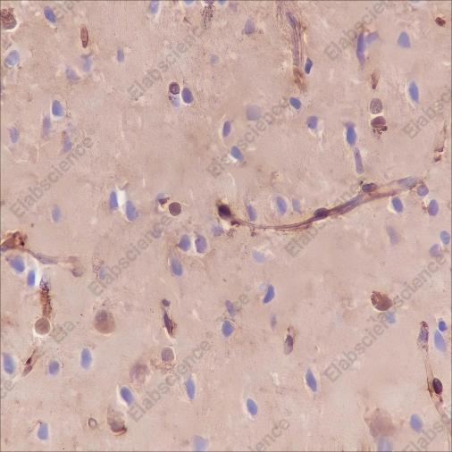 Recombinant Galectin-1 Monoclonal Antibody - 3