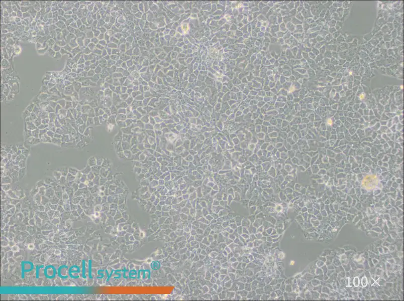 KYSE-510 Cell Complete Medium - 1
