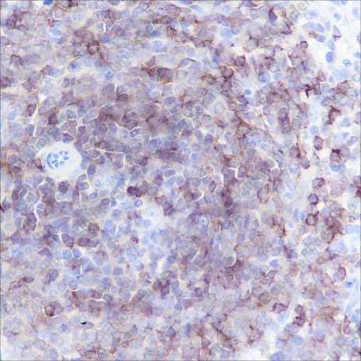 Recombinant CD79b Monoclonal Antibody - 2