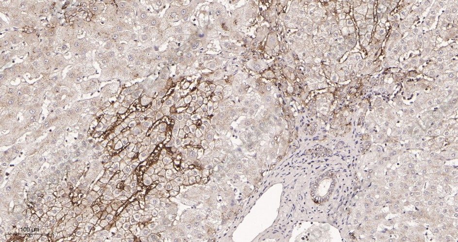 Recombinant EpCAM Monoclonal Antibody - 2