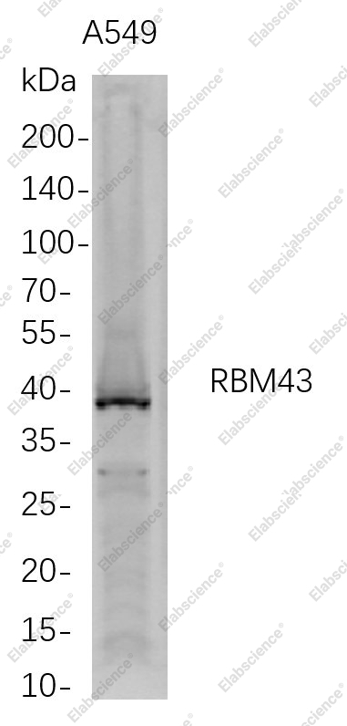 Recombinant RBM43 Monoclonal Antibody - 1