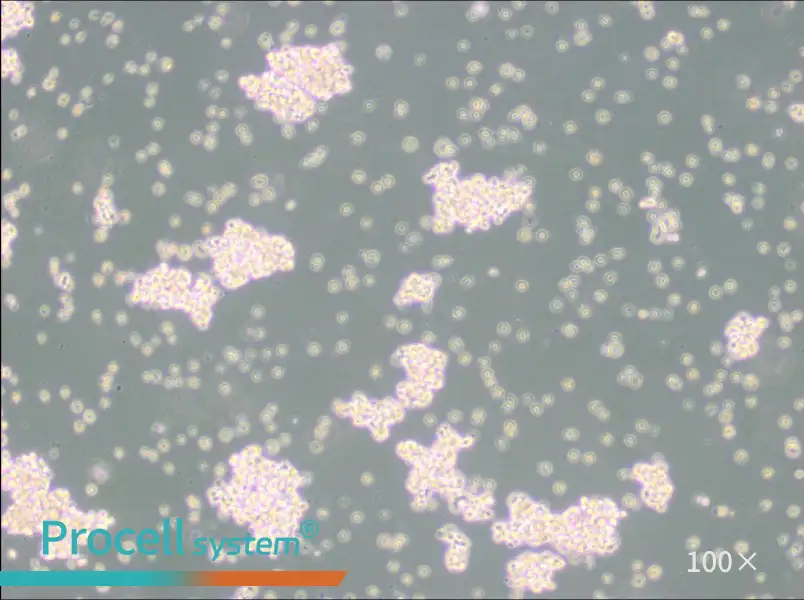 NCI-H69 Cell Complete Medium - 2