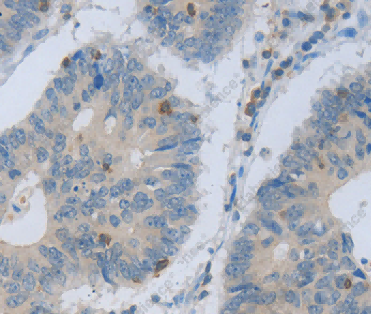 MAGEB4 Polyclonal Antibody - 2
