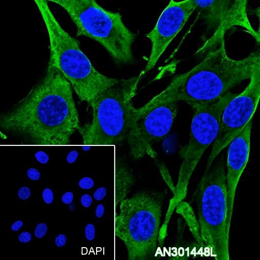 Recombinant BMP6 Monoclonal Antibody - 3