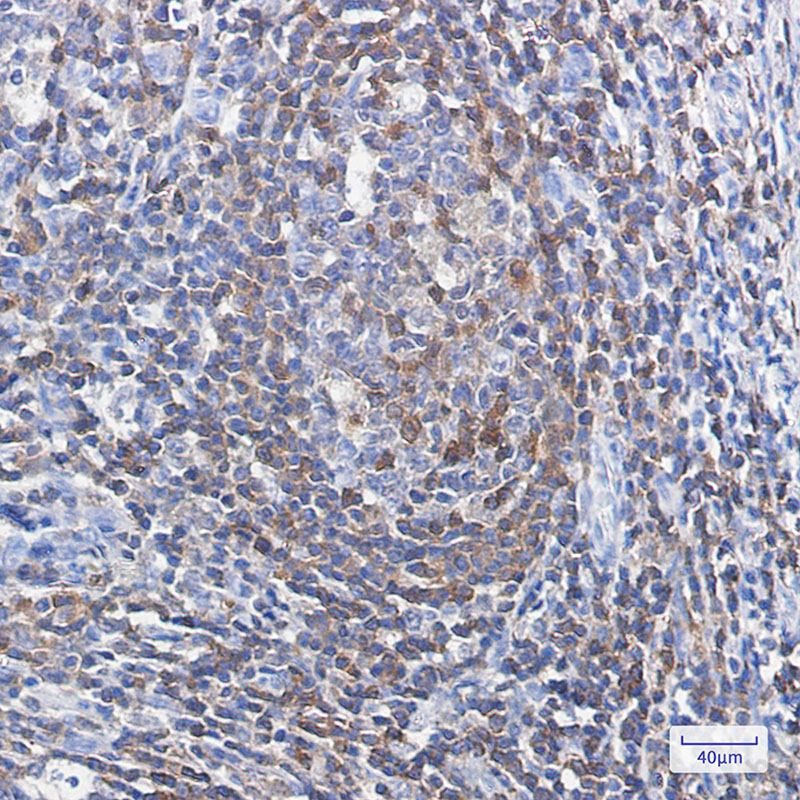 Recombinant Profilin 1 Monoclonal Antibody - 3