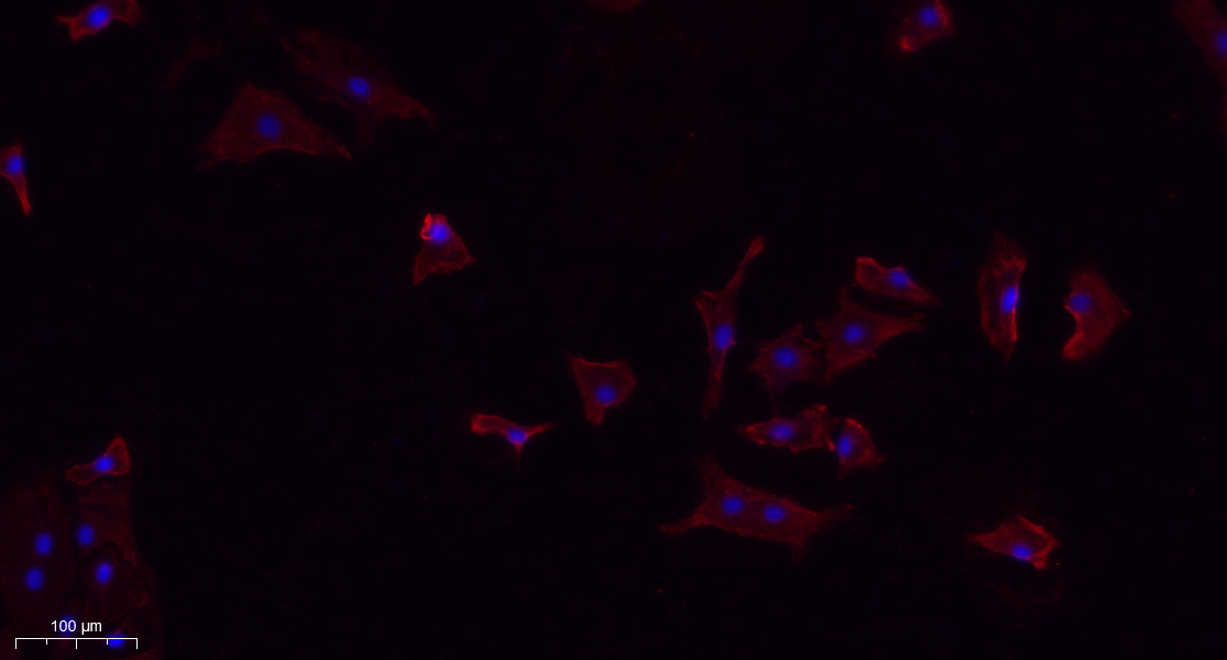 Recombinant TGF β1 Monoclonal Antibody - small - 7