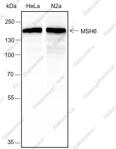 Recombinant MSH6 Monoclonal Antibody - 1