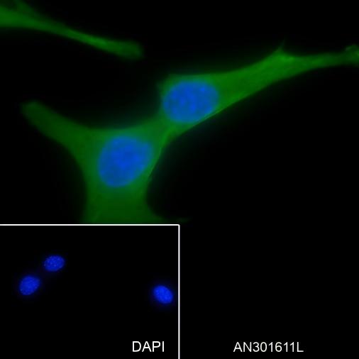 Recombinant NSE Monoclonal Antibody - small - 4