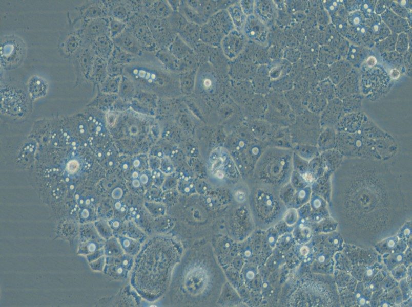 HARA-B Cell Complete Medium - 4