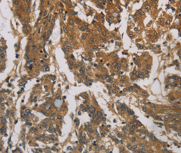 CORO1C Polyclonal Antibody - 3