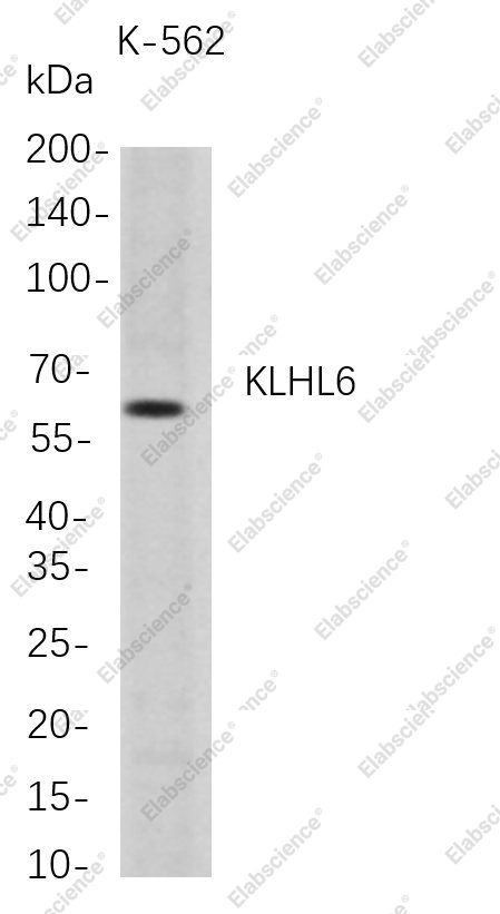 Recombinant KLHL6 Monoclonal Antibody - 1