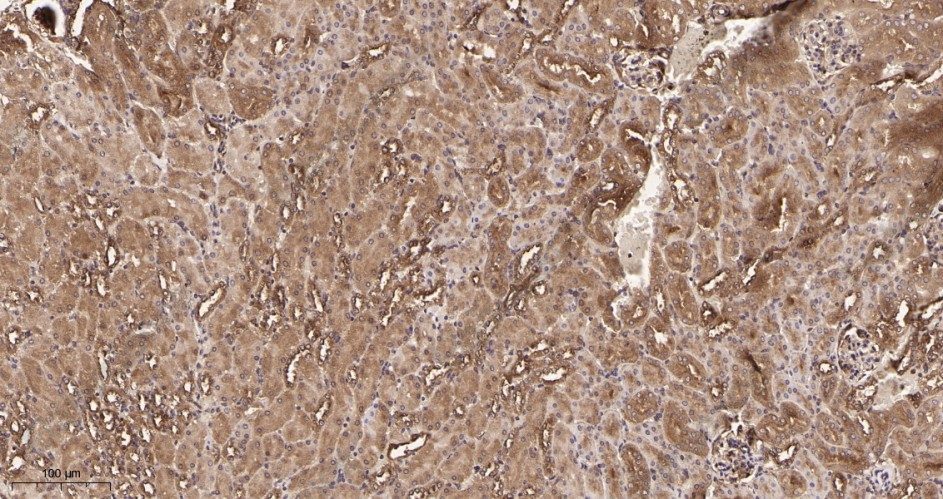Recombinant Rab 5A Monoclonal Antibody - 3