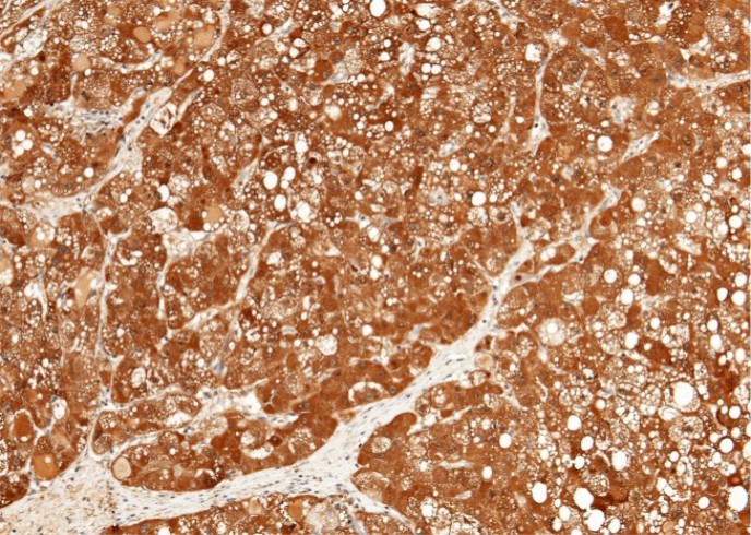 Recombinant ULBP2/N2DL-2 Monoclonal Antibody - small - 2