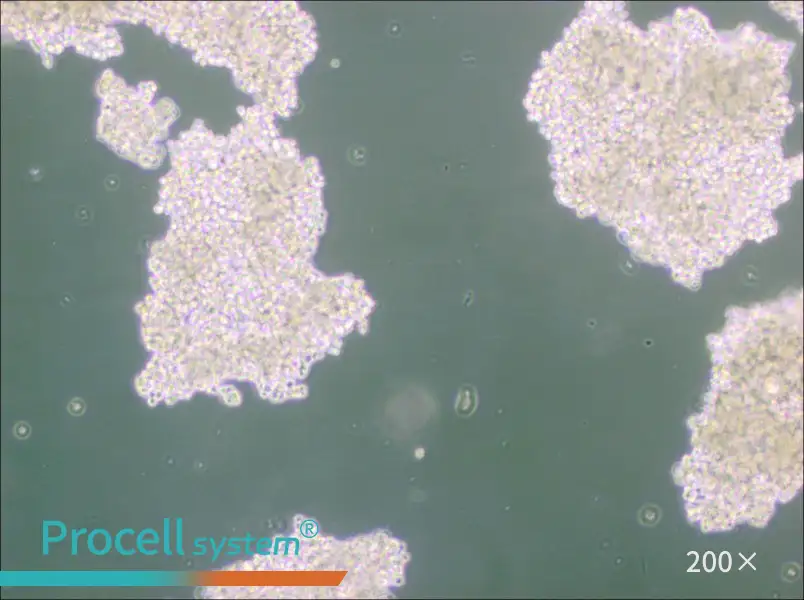 NCI-H146 [H146] Cell Complete Medium - 5